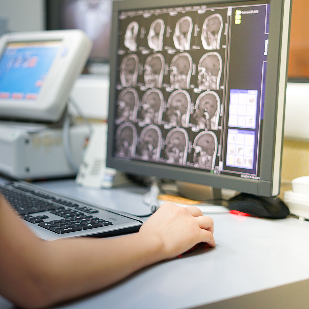 radiotechnologist-viewing-mri-brain-images